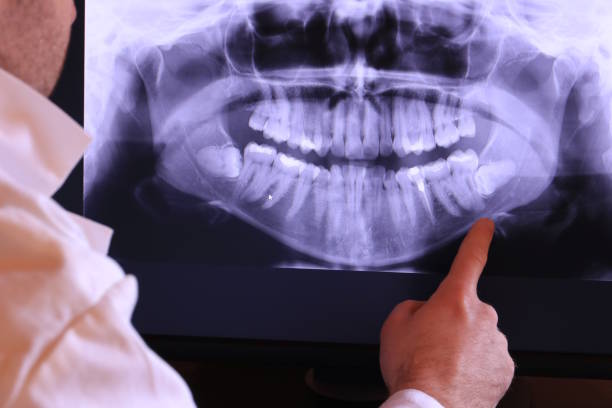 Best Tooth Pain Emergency Relief  in Converse, IN